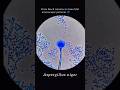 What you are observing is Aspergillus niger, a filamentous fungus widely distributed.
