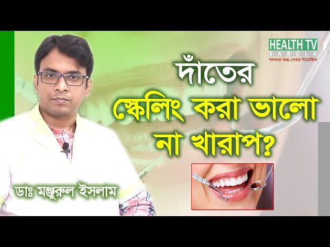 দাঁতের স্কেলিং করা ভালো না খারাপ | Dater Scaling kora Valo Na Kharap | Scaling teeth is good or bad