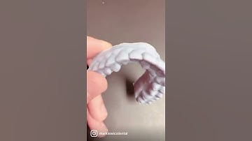 How we make custom whitening trays