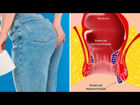 What Happens To Your Body When You Don’t Poop Every Day