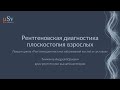 Рентгеновская диагностика плоскостопия взрослых