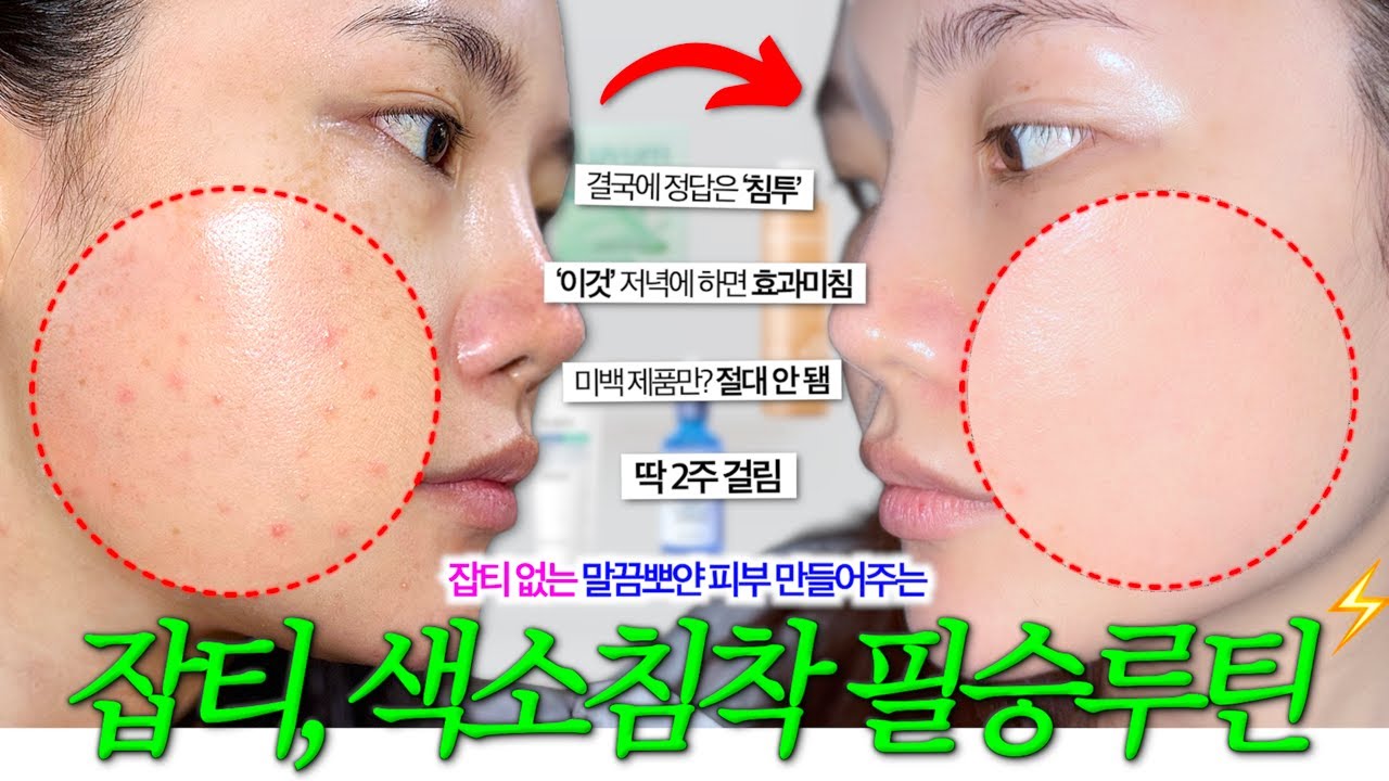 진짜 유용한 “색소침착 2주 속성루틴” | 한 번 알아두면 진심 평생 써먹음