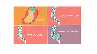 Les Mots Derriere Nos Maux - Le Filum Terminale