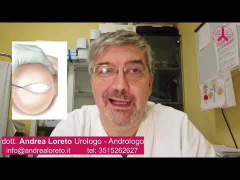 Video: Come abbassare i livelli di antigene specifico della prostata: 8 passaggi