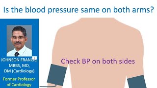 Is the blood pressure same on both arms?