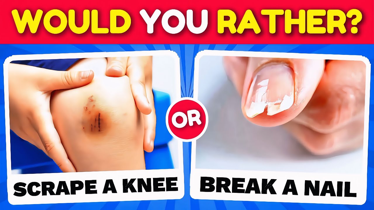 Would You Rather...? EXTREME Edition 🤔❓✅ HARDEST Choices Ever! 🔥 Quiz Duel