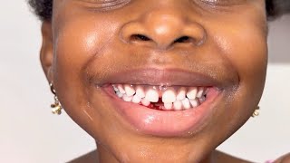 See Whose tooth came out 🙈Will Tooth Fairy Visit Her🤔
