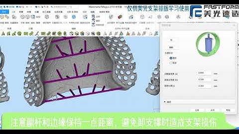 how to build nesting for 3d printing metal dental RPD frameworks products
