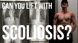 How I Lift Weights Exercise With Scoliosis Spinal Fusion Youtube