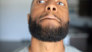 Life After Minoxidil (week# 21)