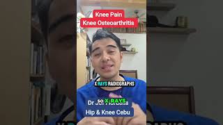 Knee Pain Solutions: Osteoarthritis Explained by Dr. Zebuaño