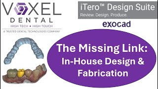 iTero Design Suite - The Missing Link For In-House Milling & Printing