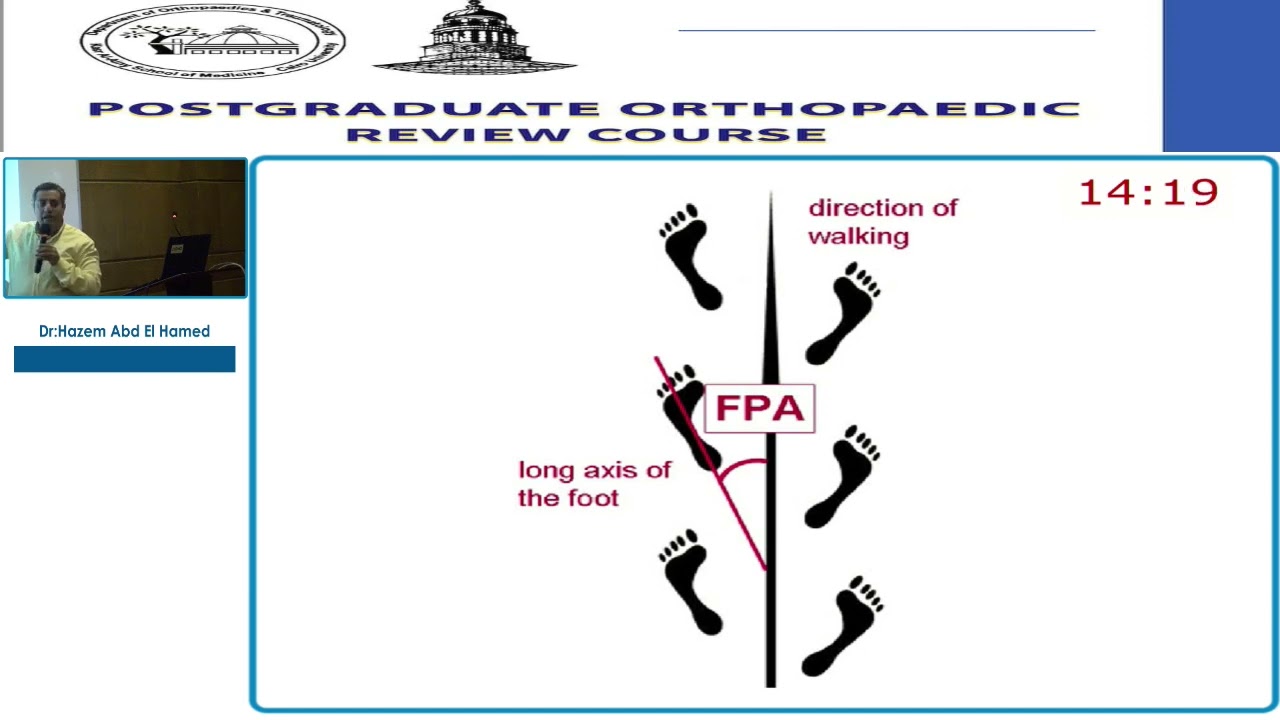 16   In Toeing Gait    Hazem Abd El Hamed