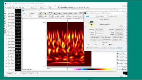 Magnetoencephalography, Electroencephalography, NeuroscienceMEG/EEG Time Frequency Analysis 03
