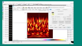 Magnetoencephalography, Electroencephalography, NeuroscienceMEG/EEG Time Frequency Analysis 03