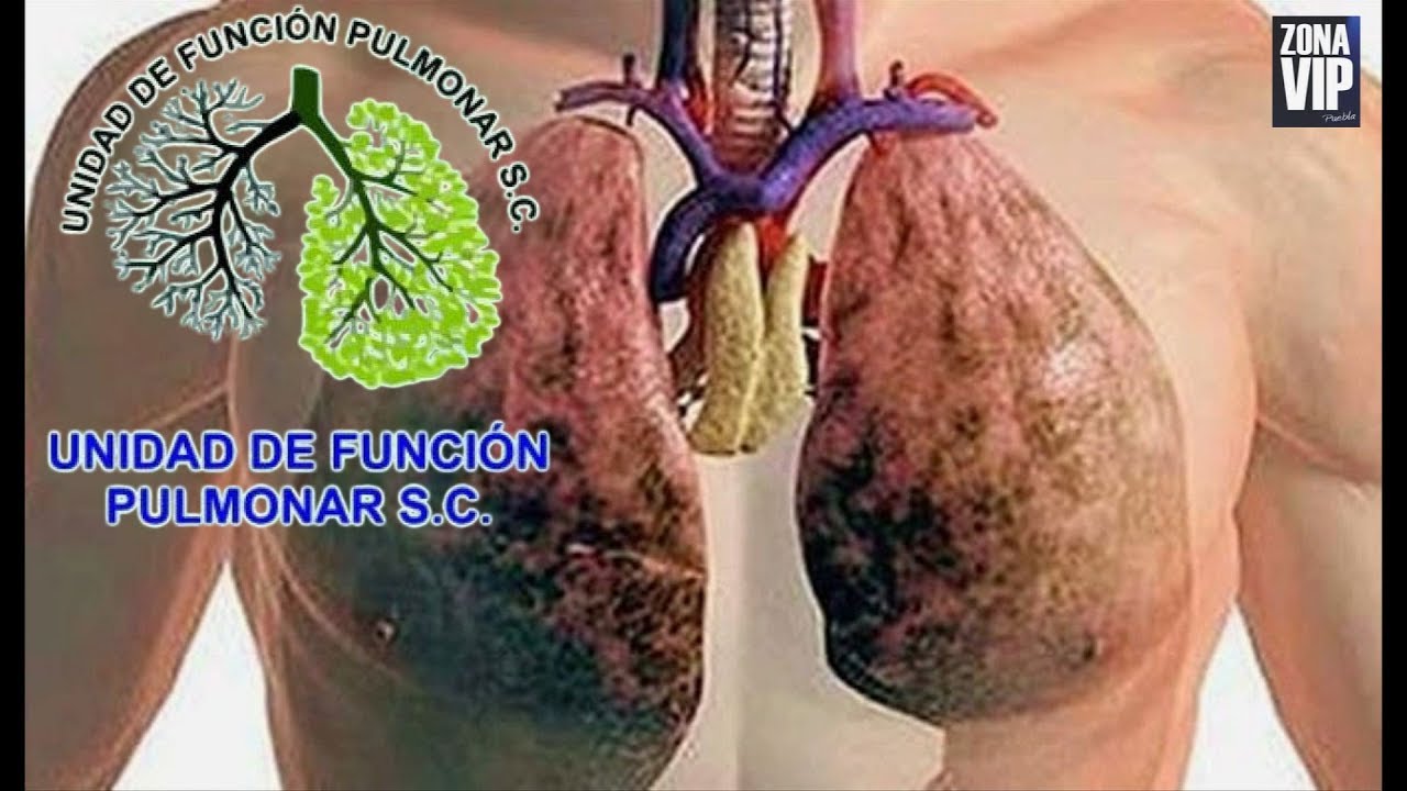 INSUFICIENCIA PULMONAR YouTube INSUFICIENCIA PULMONAR YouTube
