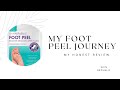 My Honest Skin Republic foot peel review| My foot Peel journey 🤮🤢| What a shocker 😳🫣 #skincare