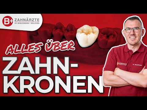 Video: So Wählen Sie Eine Zahnkrone Aus