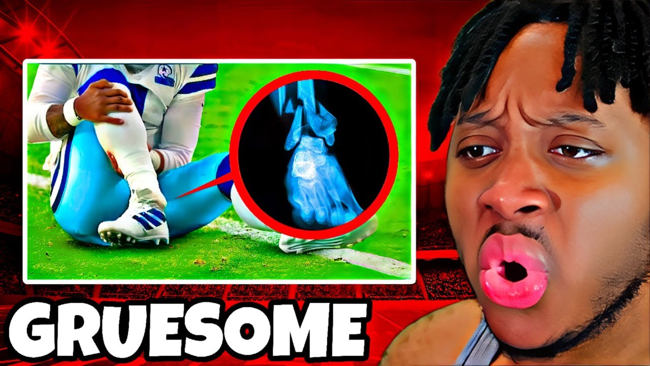 Reacting to 20 Most DANGEROUS Injuries In NFL History - YouTube