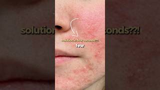 Your Skin Needs This