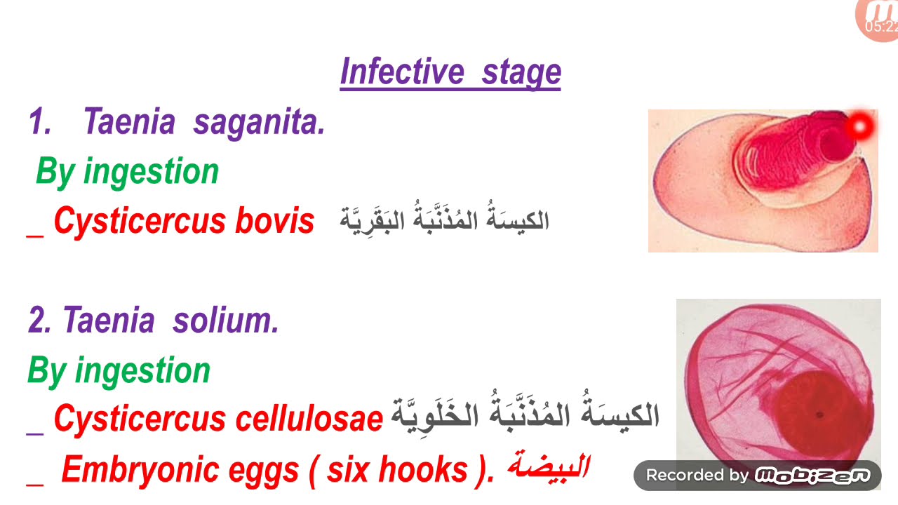Taeniasis  /داء الشريطيات/  البقرية / الخنزيرية