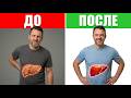 Как ОБРАТИТЬ Жировую Болезнь Печени (С Лечением и Без)