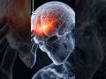 This is why you get headache #facts #viral #ytshorts #shorts #education #science #motivation