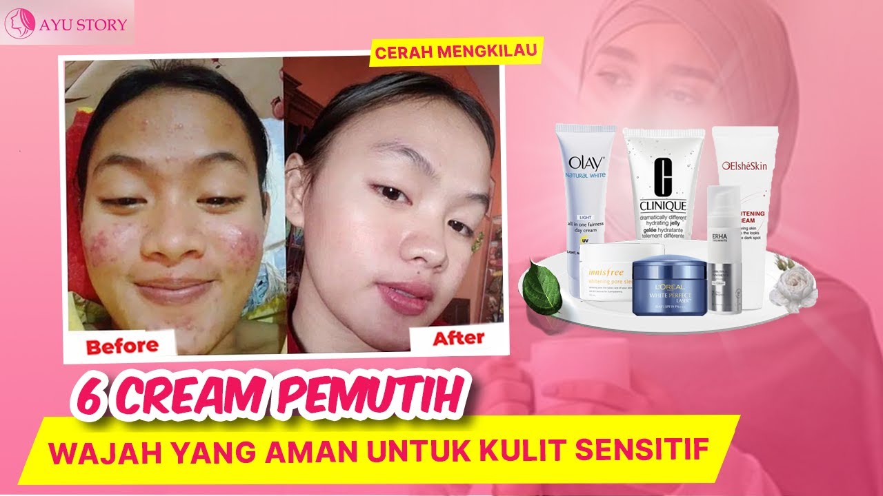 6 REKOMENDASI CREAM PEMUTIH WAJAH YANG AMAN UNTUK KULIT SENSITIF YouTube