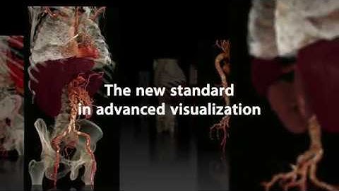 Global Illumination rendering - The New Standard in Advanced Visualization
