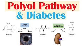 Polyol Pathway & Diabetes | The Role of Polyol Pathway in Diabetes Pathogenesis