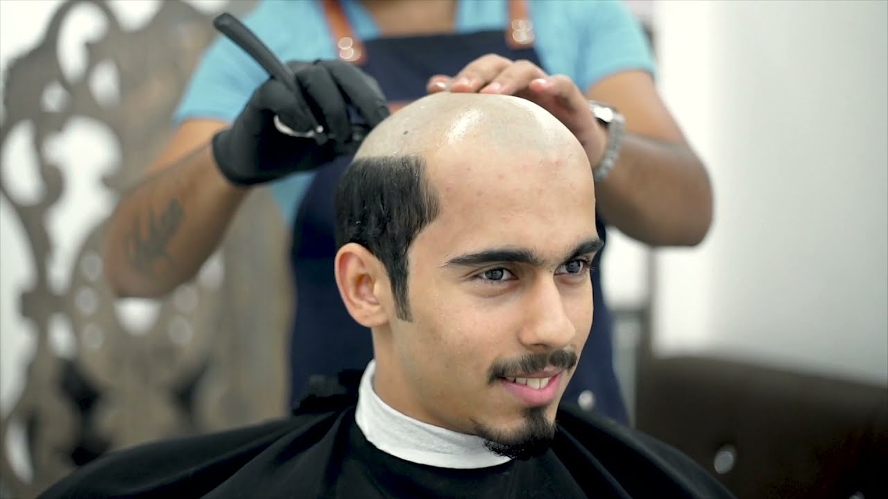 افضل طريقة لتركيب شعر رجالي #حسن_المهندس #hair_style - YouTube