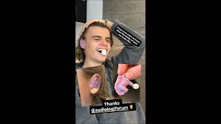 Oscar Stembridge at Audiologiforum to get new molds (Oct. 25th, 2025).