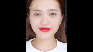 Đừng giữ "định kiến" phun môi KHÔNG dành cho giới trẻ #phunmoi | HỆ THỐNG THẨM MỸ QUỐC TẾ LINH ANH