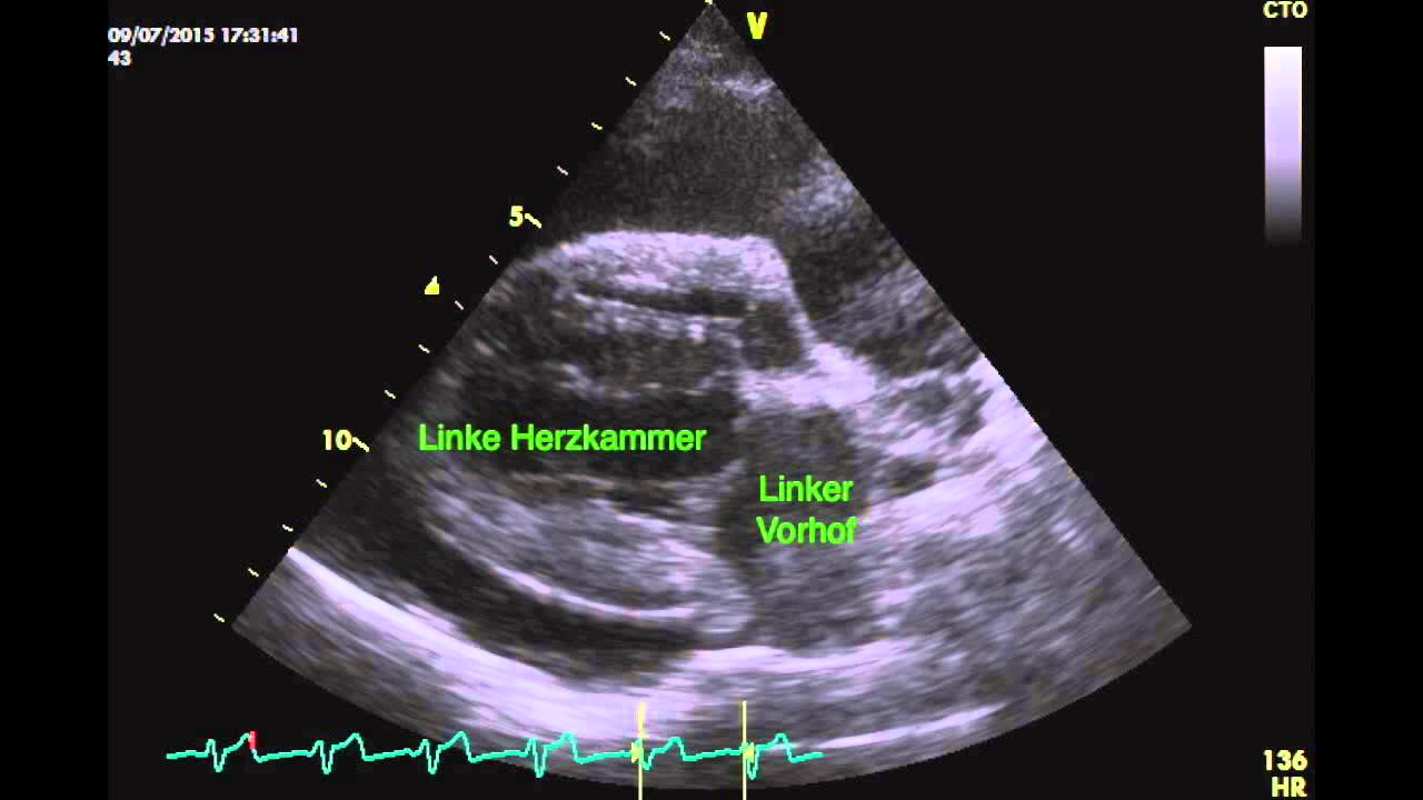 Herzbeutelerguss = Perikarderguss Hund YouTube