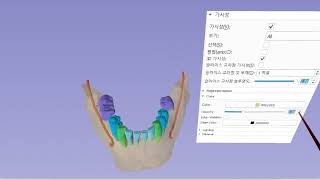 SlicerVR GUI widget interaction demo in Korean