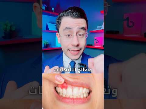 اقوي وصفة لتبييض الاسنان 