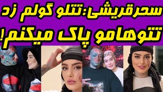 امیر تتلو گولم زد | سحرقریشی دنبال جراح پلاستیک خوب میگرده تتووخالکوبی صورتشو پاک کنه