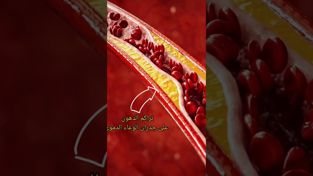 ماذا تسبب الدهون اذا تراكمت في الوعاء الدموي؟إجاباتكم في التعليقات🧬🩸