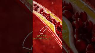 ماذا تسبب الدهون اذا تراكمت في الوعاء الدموي؟إجاباتكم في التعليقات🧬🩸