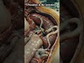 Parasites in the intestines  #humananatomy #aianatomy #3danatomy #healtheducation #anatomy