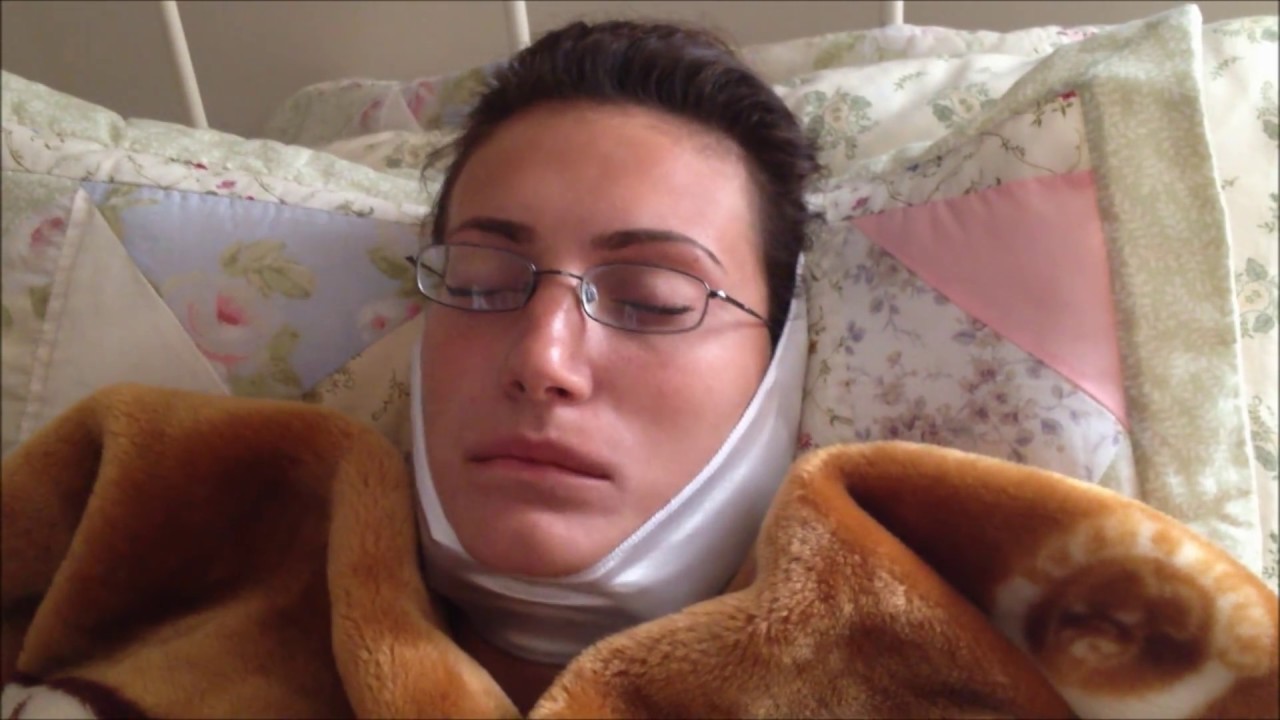 Sister Gets Wisdom Teeth Removed - Hilarious Post Op