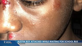 12-year-old boy assaulted while waiting for school bus