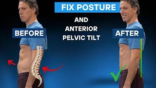 Fix Anterior Pelvic Tilt & Align Your Spine With These 3 Core Exercises