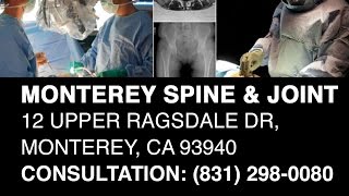 Monterey Spine and Joint - (831) 298-0080 - Monterey Spine and Joint Review