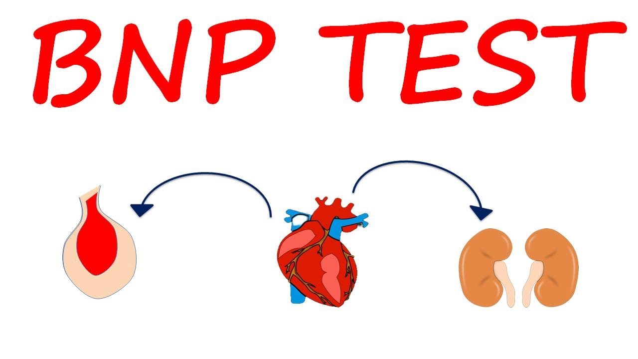 Brain Natriuretic Peptide BNP Test For Heart Failure YouTube