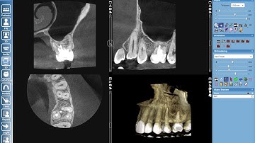 Romexis Case Presentation