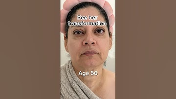 See her transformation | Face Fitness | Face Yoga | Face Massage