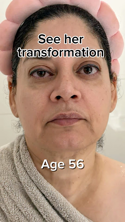 See her transformation | Face Fitness | Face Yoga | Face Massage
