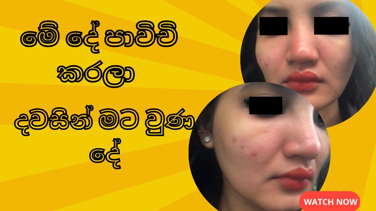Swollen face after using this product (My BB Cream එක