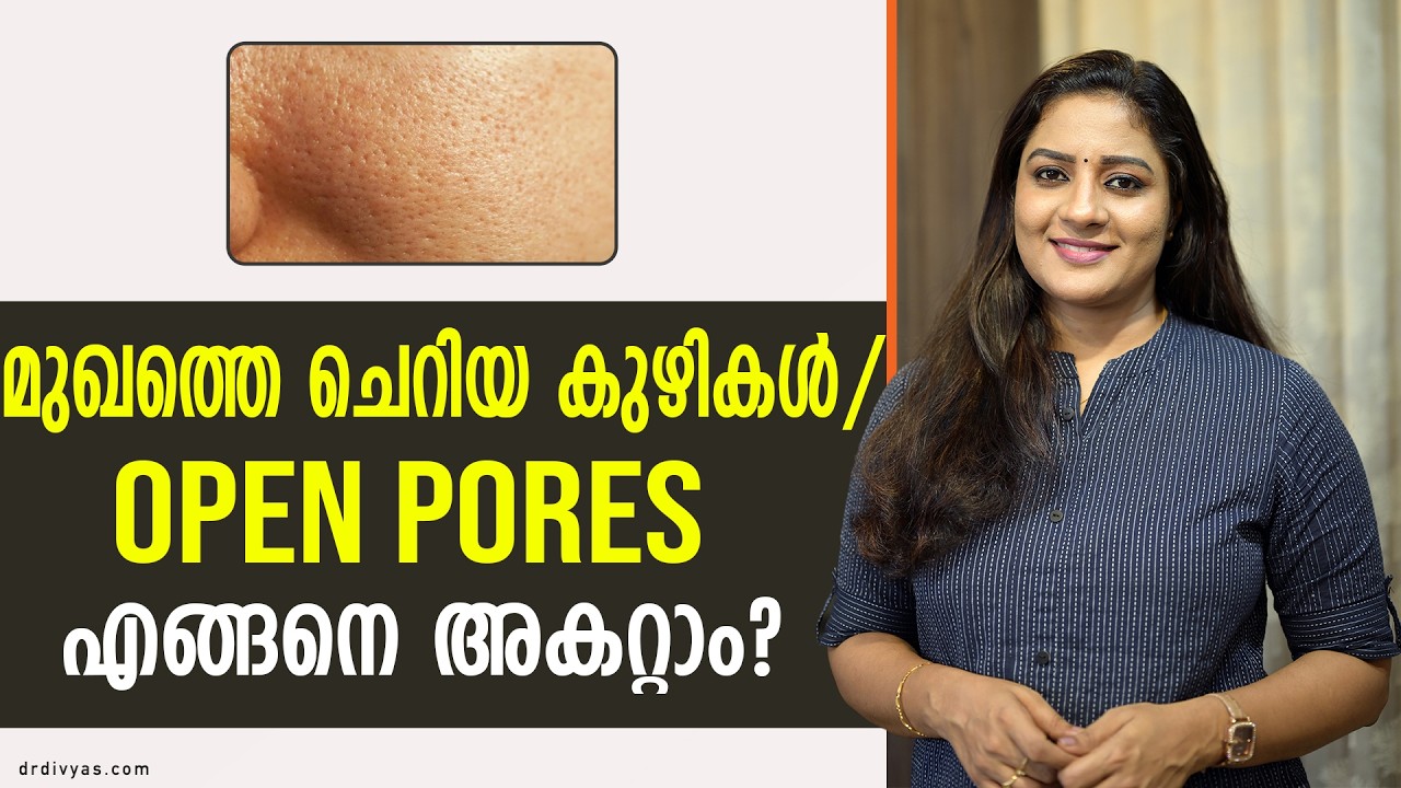 മുഖത്തെ ചെറിയ കുഴികൾ എങ്ങനെ അകറ്റാം Simple Ways To Get Rid Of Open Pores Permanently & How to treat